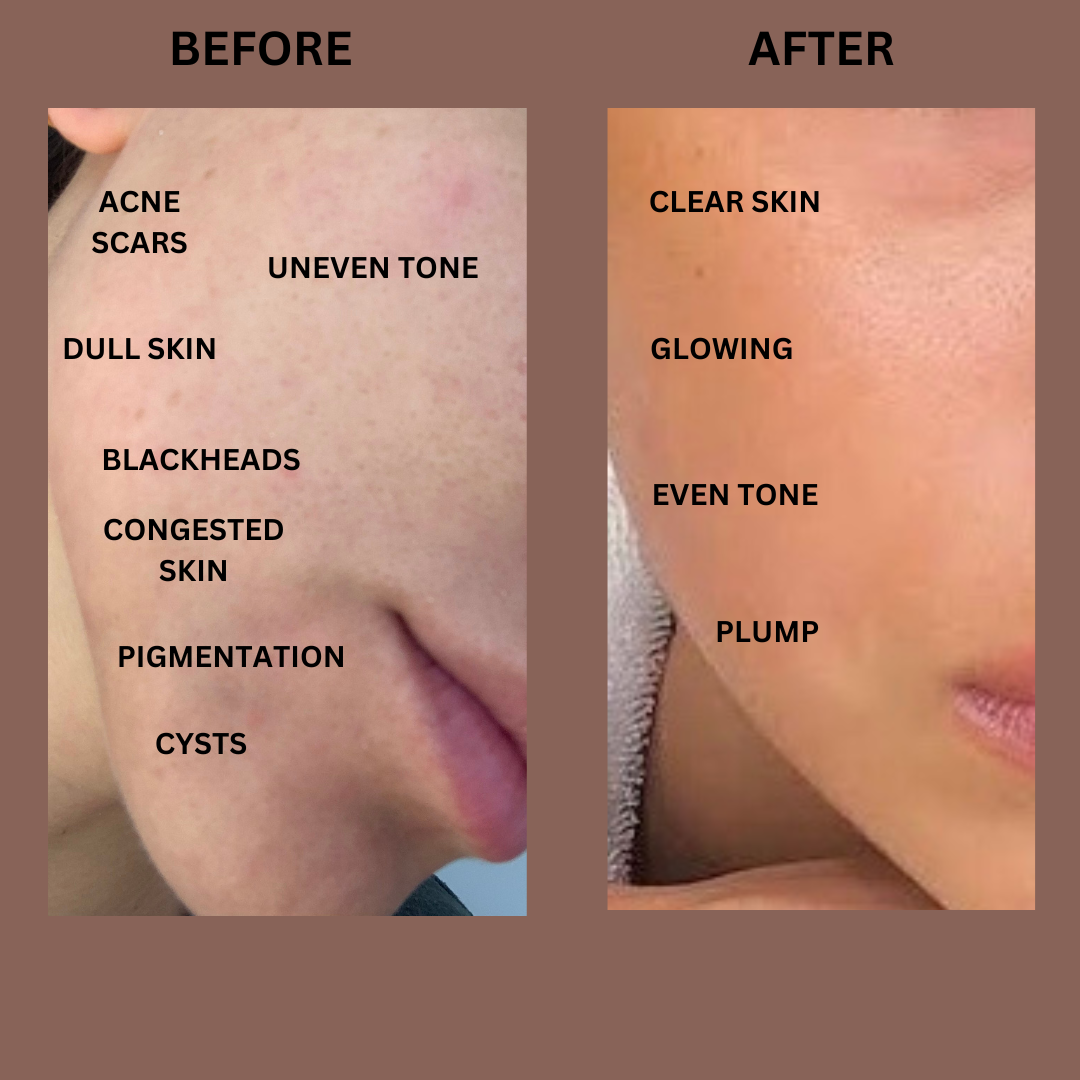 Clear Skin Elixir