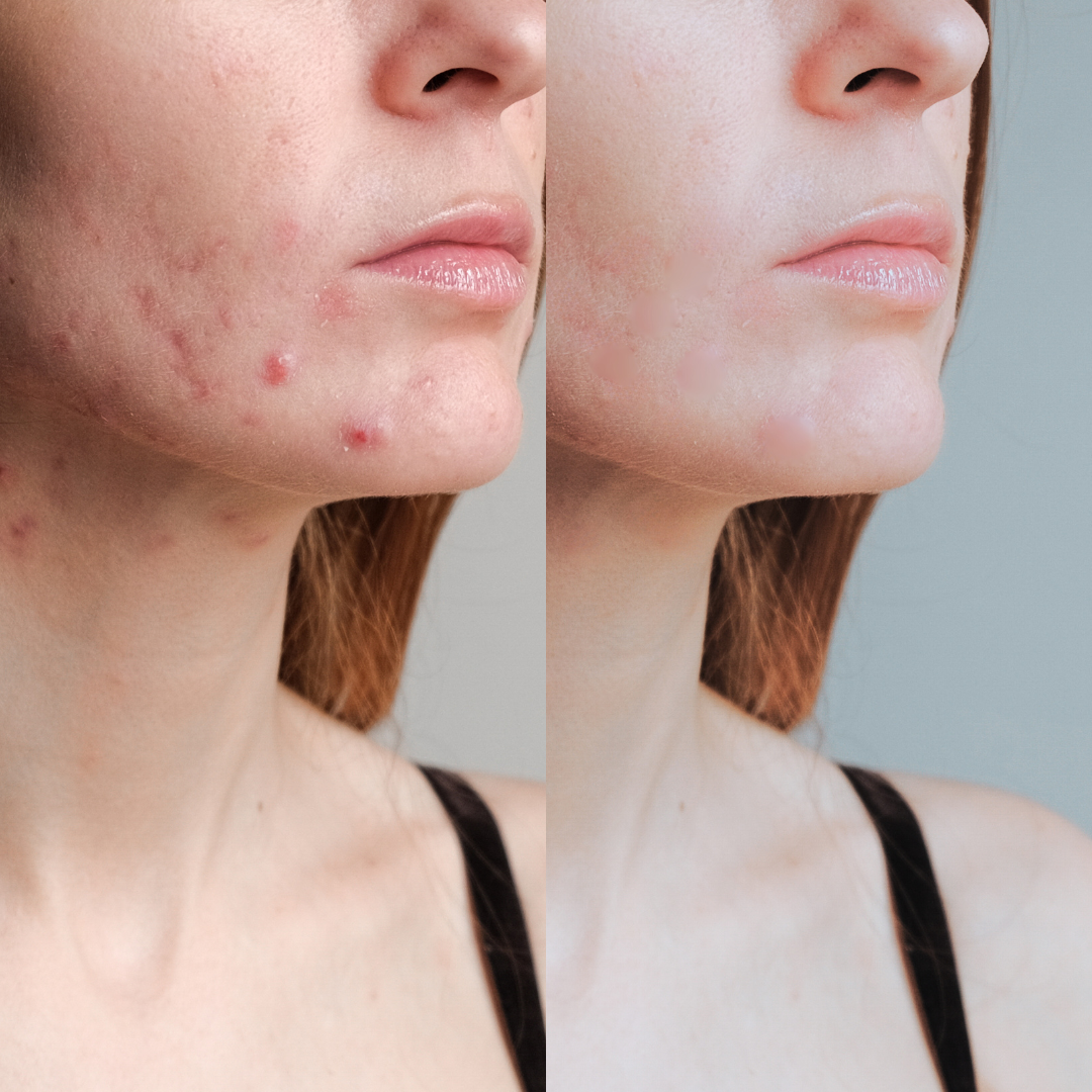 Clear Skin Elixir